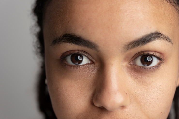 5 Effective Home Remedies for Reducing Dark Circles