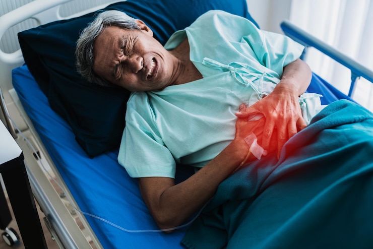 Understanding Hernias: A Comprehensive Guide